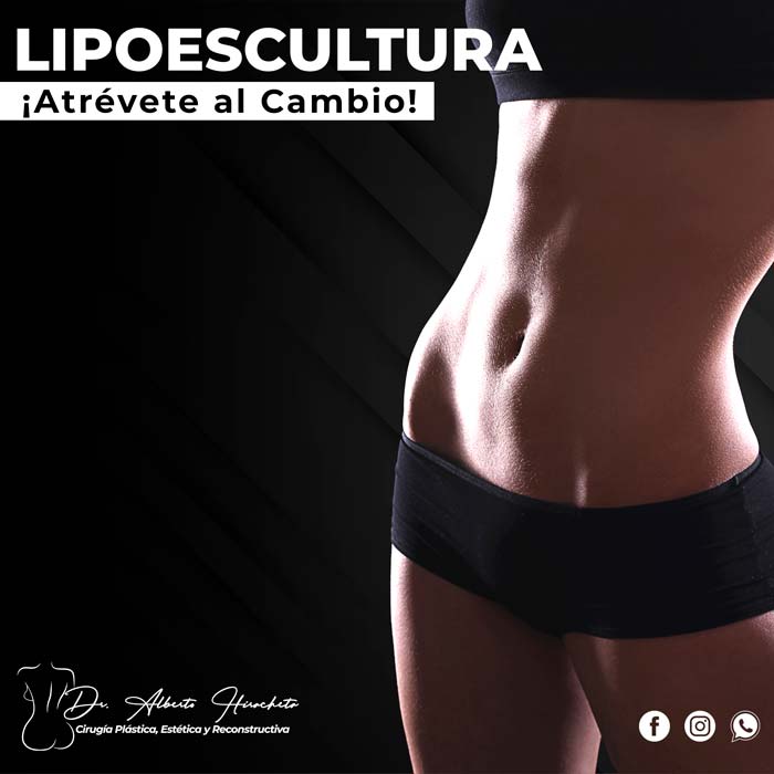 Lipoescultura Dr Alberto Hiracheta Torres Cirujano plastico en chihuahua